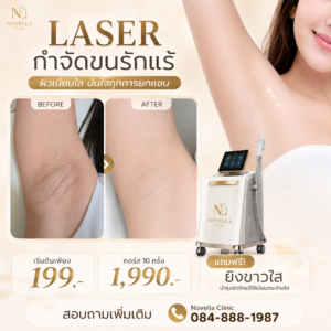 ขนรักแกร้-1