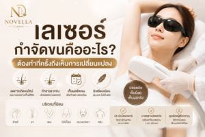 Novella-เลเซอร์กำจัดขนคืออะไร